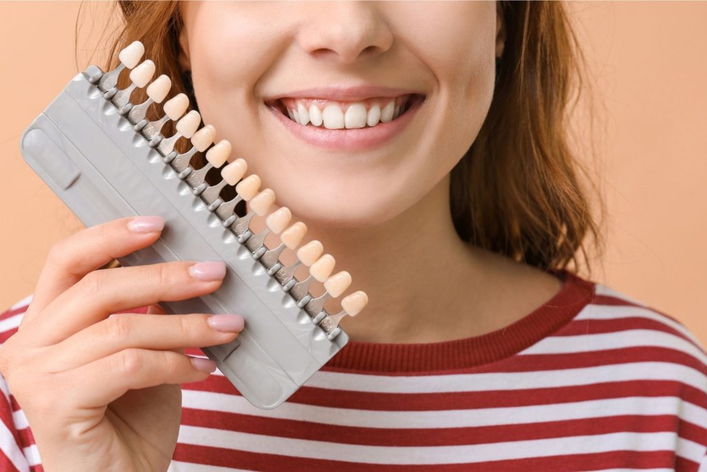 How to Take Care of Dental Veneers