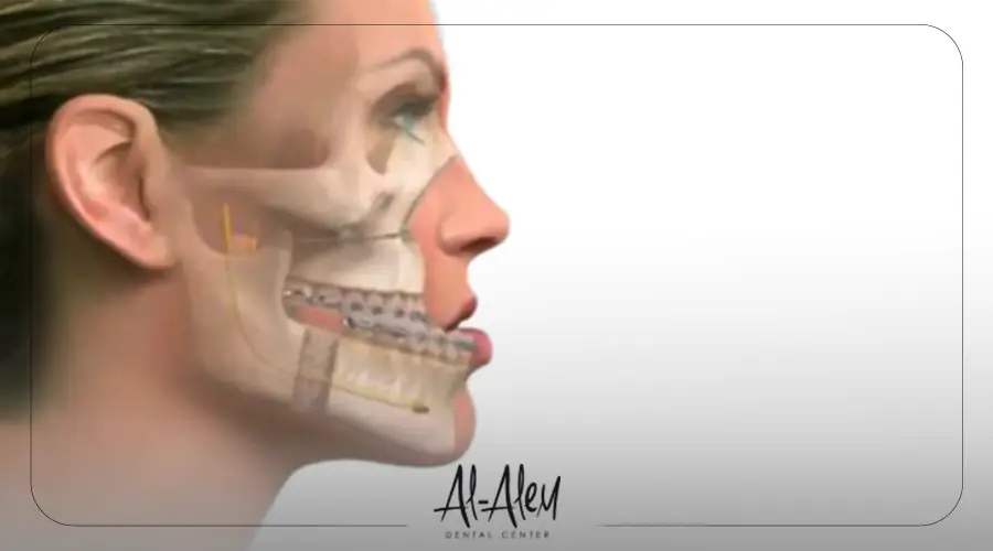 افضل دكتور جراحة الفك في مصر