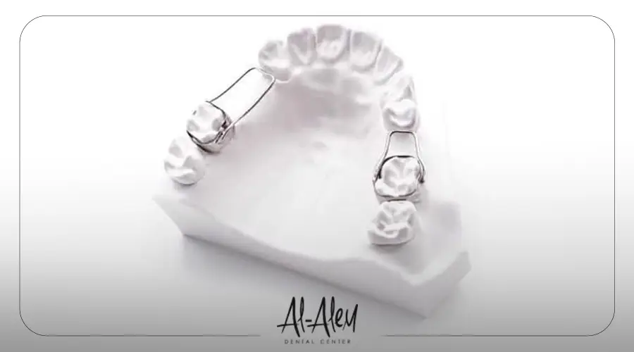 بدائل زراعة الأسنان