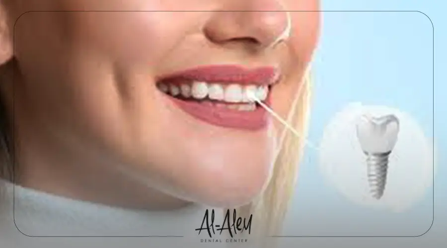 بعد زراعة الاسنان اليوم الاول_