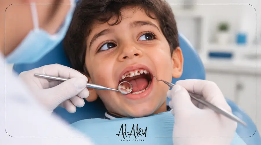 علاج تسوس الأسنان اللبنية